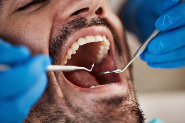 Best Emergency Root Canal Treatment in Martinsville, NJ